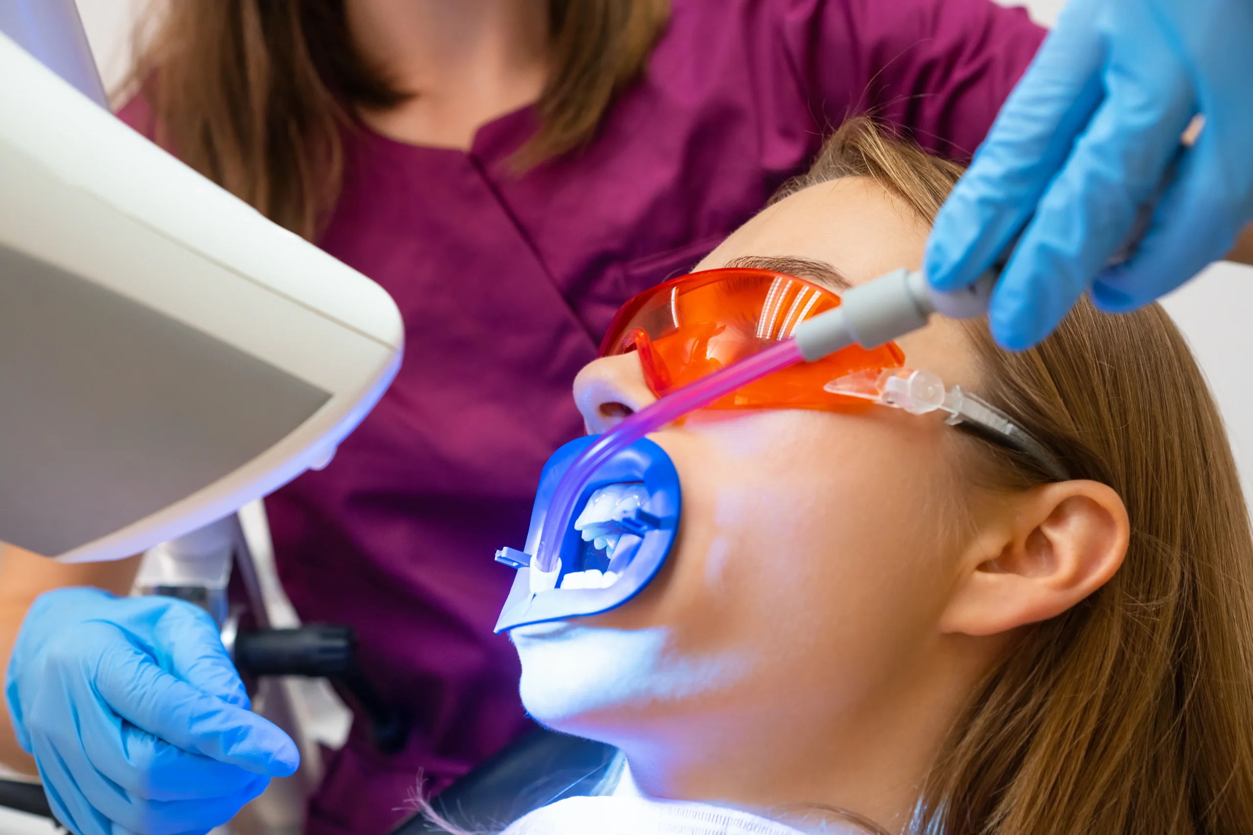 I have really yellow teeth, should I go for a whitening procedure? 