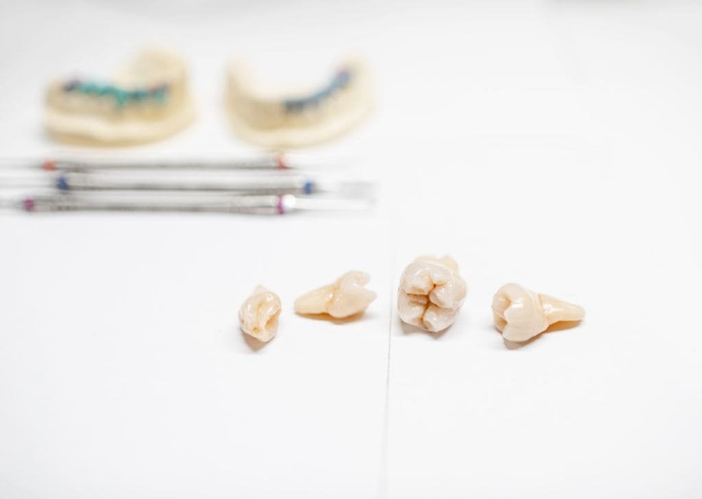 Root Canal Treatment Cost Malaysia | Govt vs Private