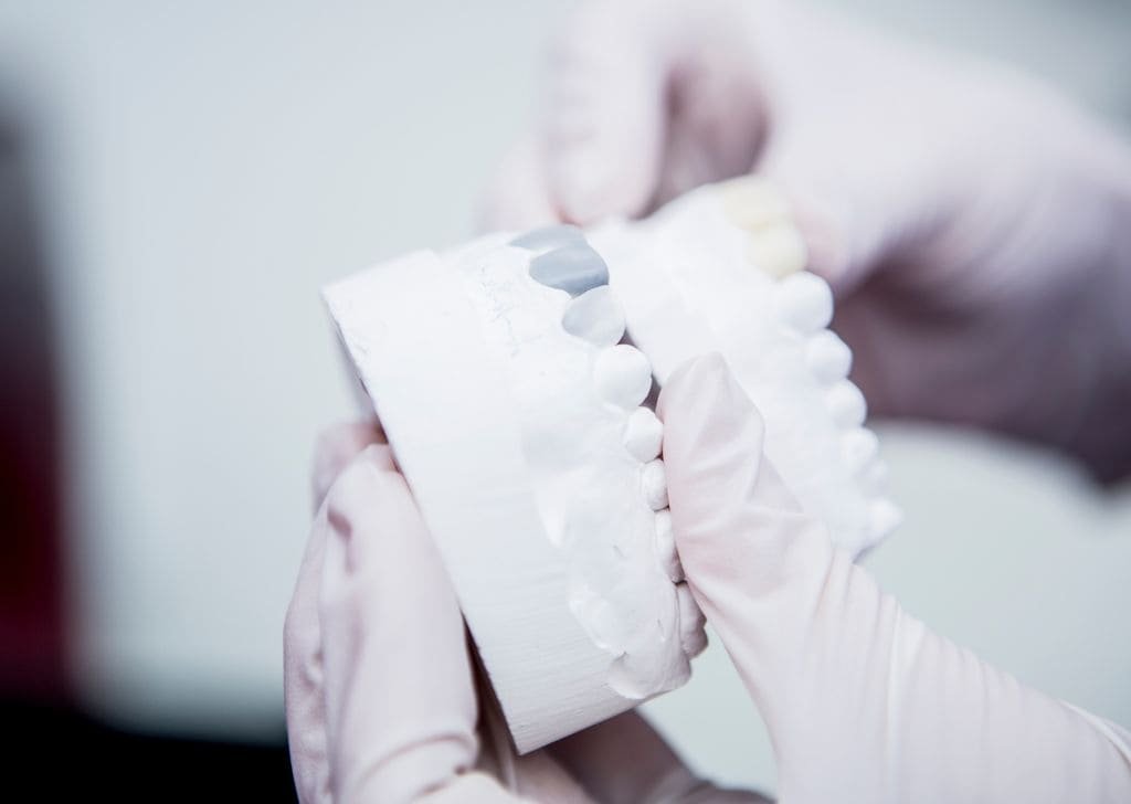 How to Maintain a New Tooth Filling | Expert Guide