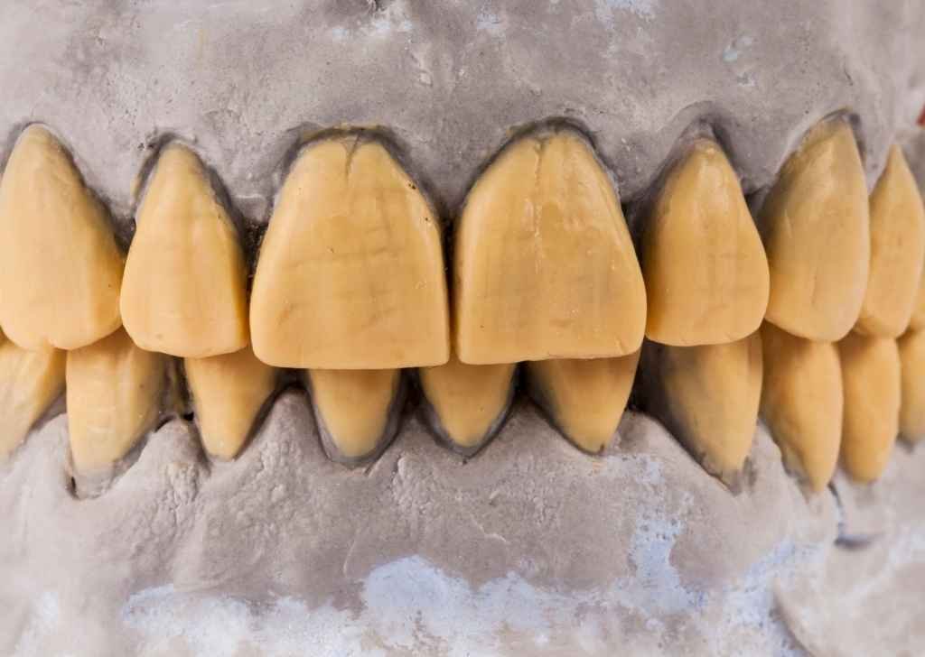 Reasons why you have really yellow teeth
