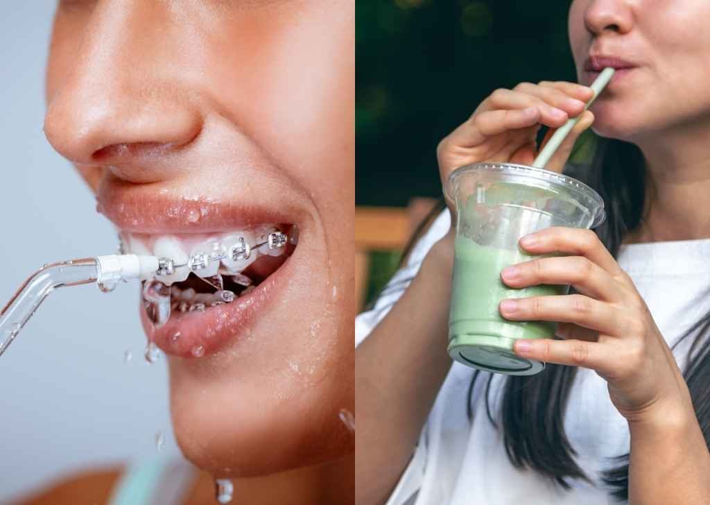 Why is my teeth still yellow after brushing even after quitting coffee and tea? 