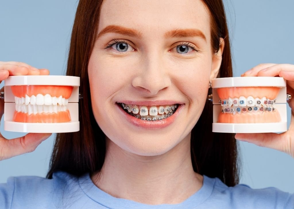 Here's why getting braces may be the cause of really yellow teeth.
