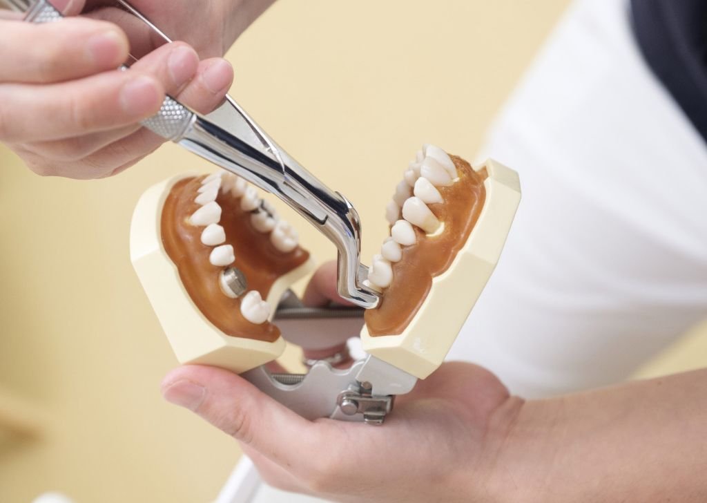 Tooth Extraction Cost in Malaysia 1 1