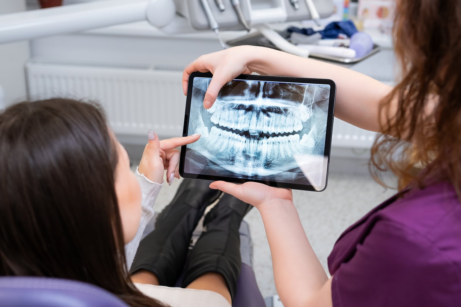 tooth extraction