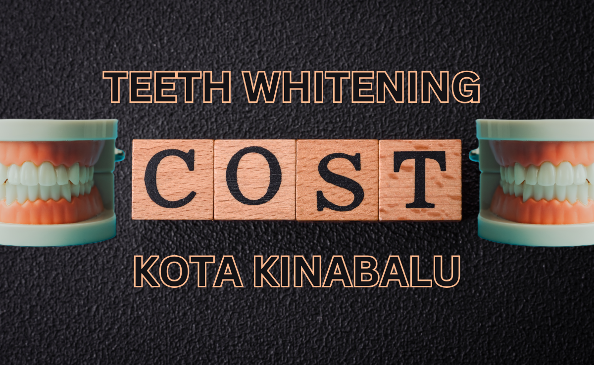 Teeth whitening cost in kota kinabalu