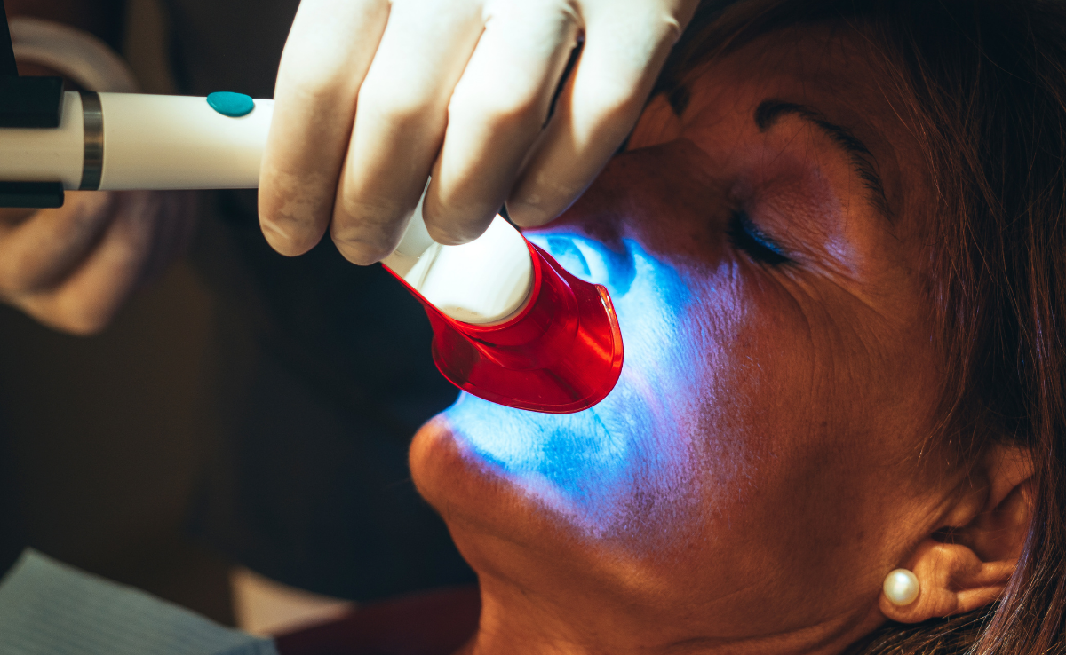 Professional teeth whitening