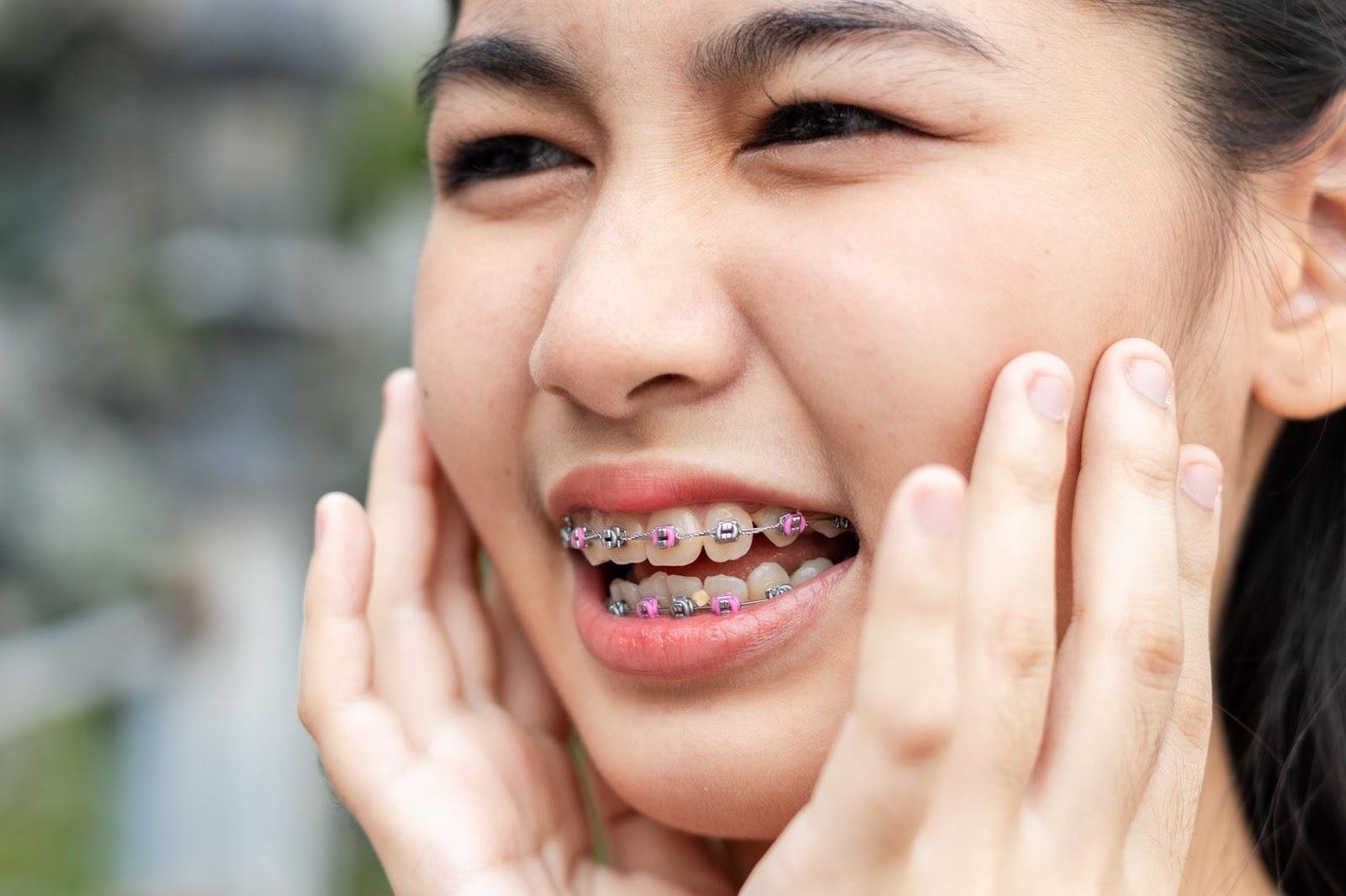 How to Get Rid of Braces Pain