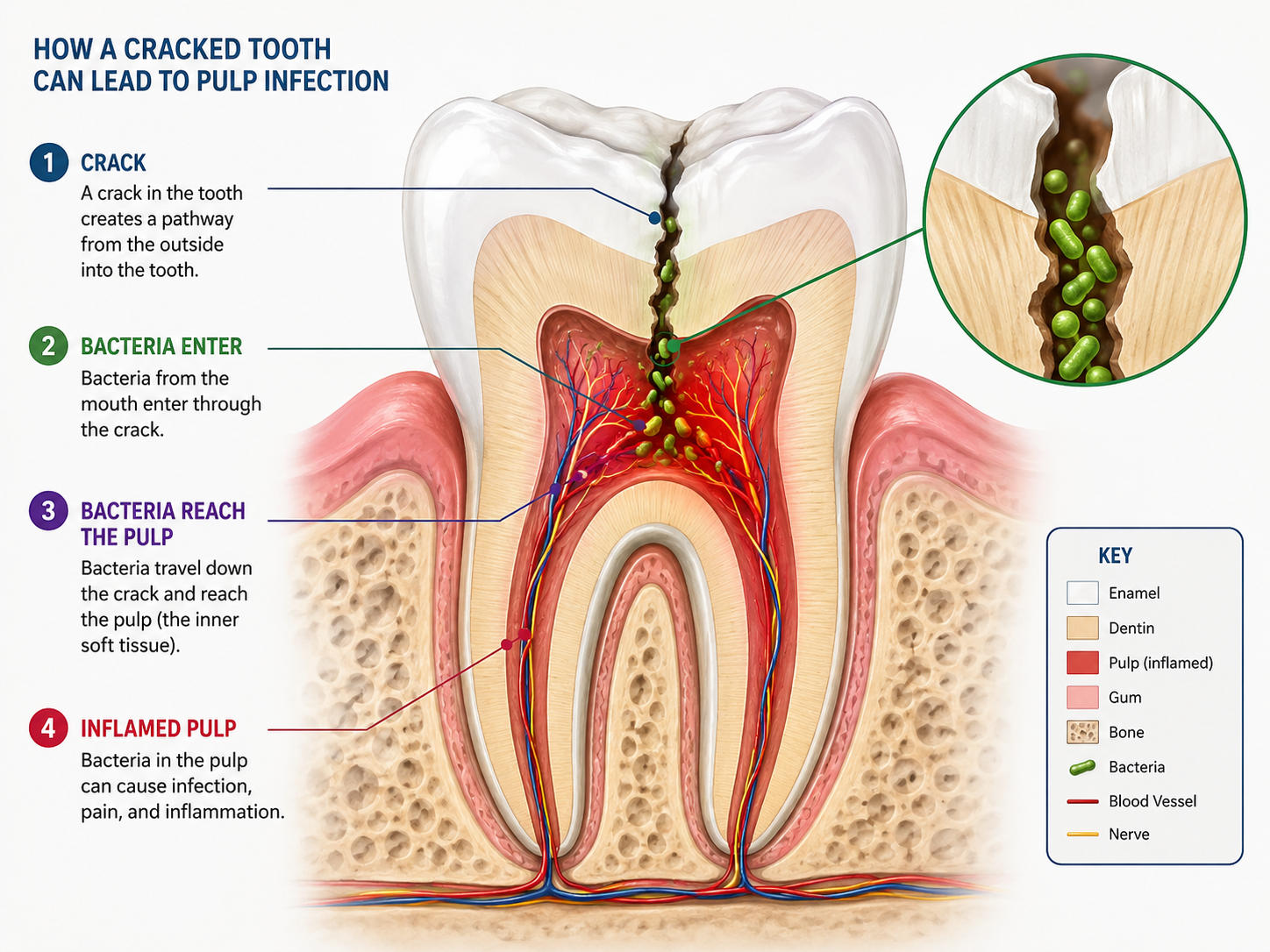 infected pulp, swollen gum