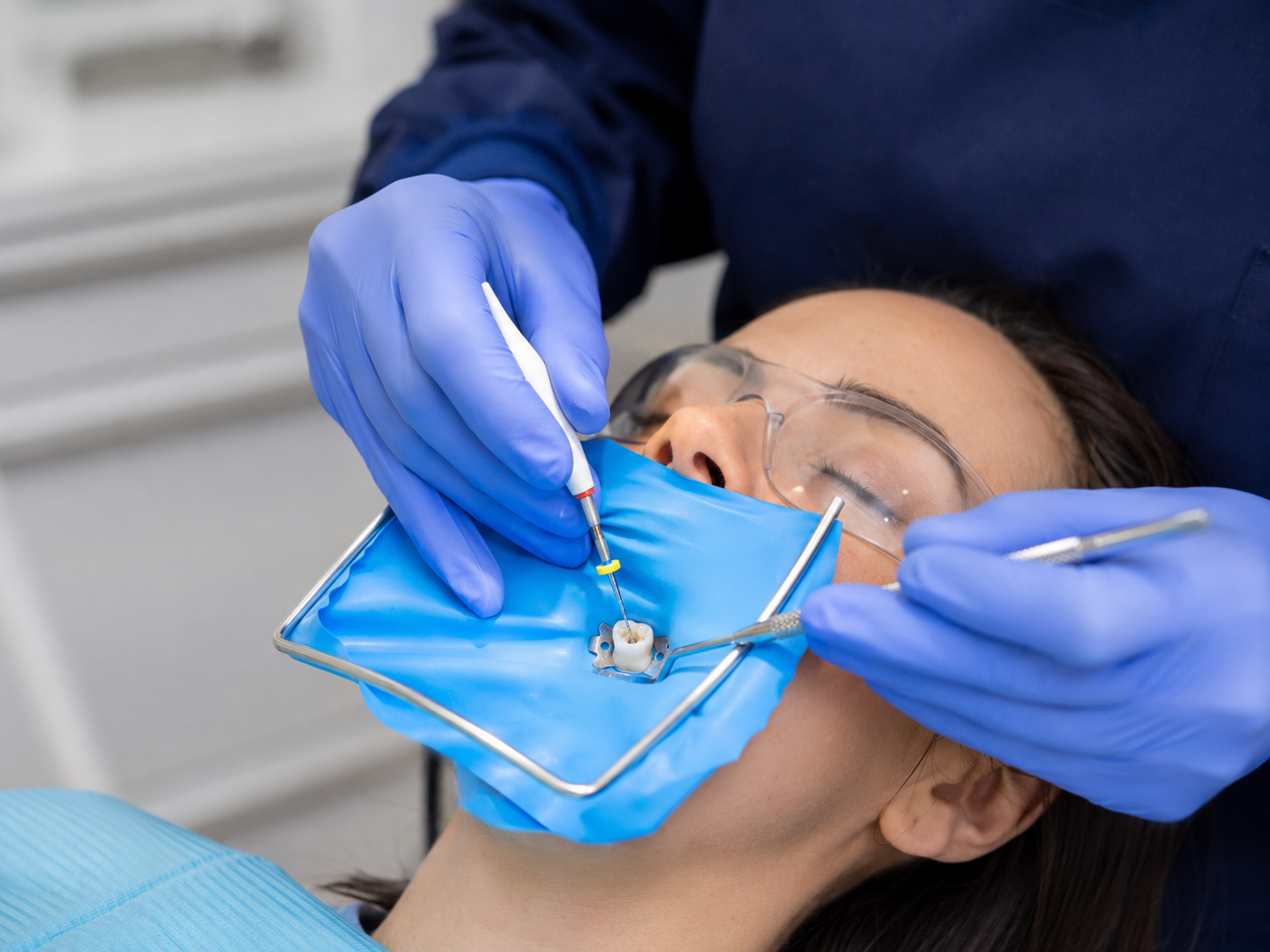 Root Canal Procedure in Malaysia: What Happens at Every Step 5 Endodontic files used to clean root canals