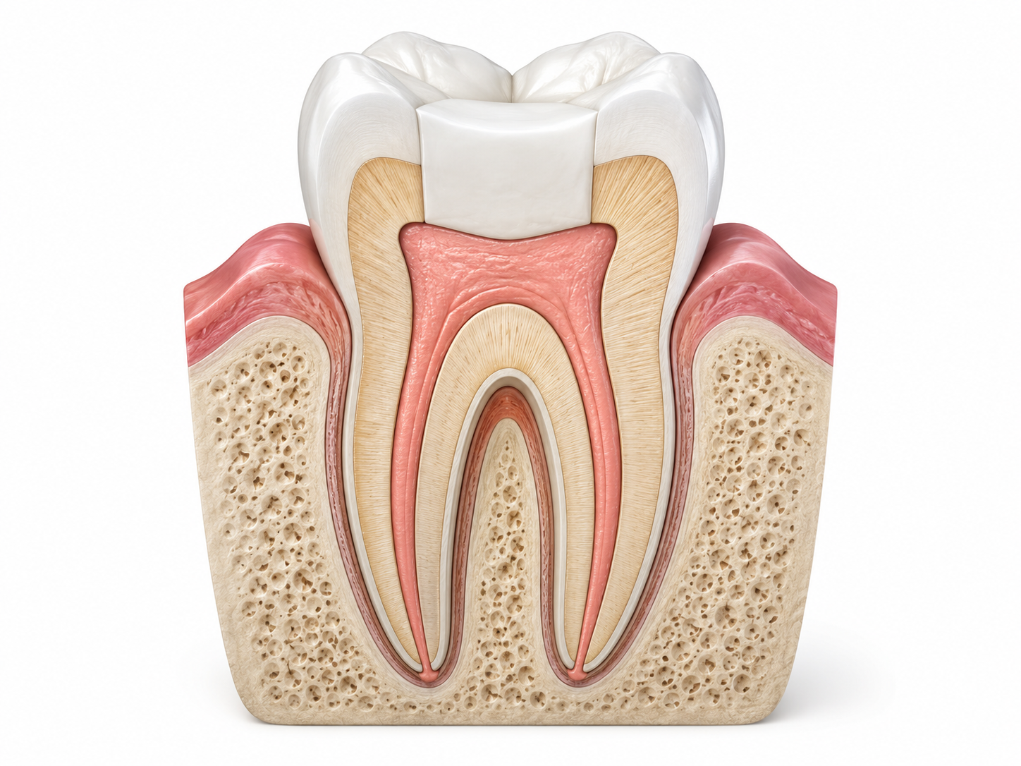 Root Canal Procedure in Malaysia: What Happens at Every Step 6 Filling and Sealing the Canals